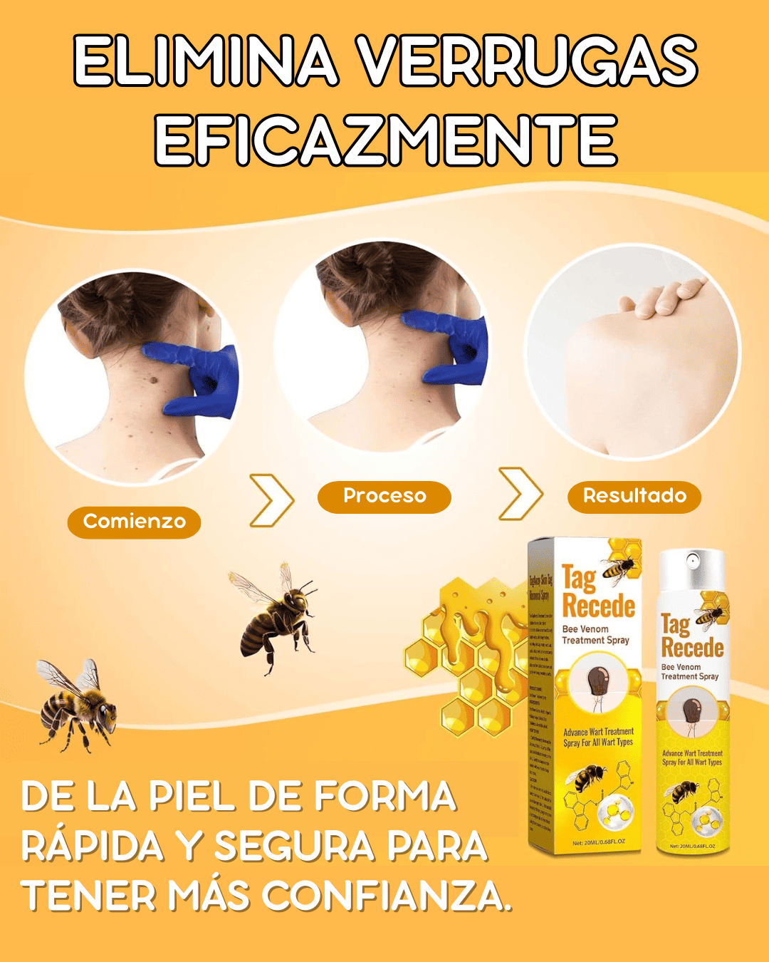 SUPER PROMO SPRAY ELIMINADOR DE VERRUGAS - TAG RECEDE