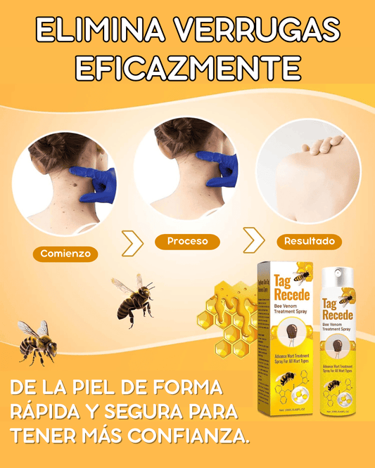 SUPER PROMO SPRAY ELIMINADOR DE VERRUGAS - TAG RECEDE